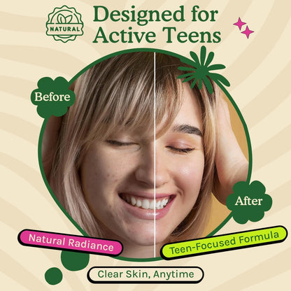 Acné Suplemento para Adolescentes con Vitaminas A, B, C, E y Biotina para una Piel Clara y Radiante, Apoya la Producción Equilibrada de Grasa - Sin Gluten, 60 Cápsulas