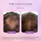 Omvi Formulas, Suplemento para el Crecimiento del Cabello con Biotina 20.000 mcg, Colágeno, Queratina, Vitaminas A, C, D3 y B12, Cabello, Piel y Uñas Fuertes, No OGM, Sin Gluten, 120 Cápsulas