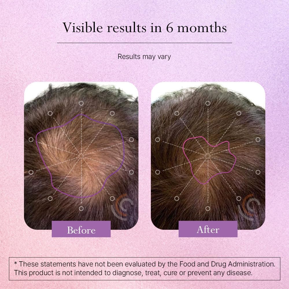 Omvi Formulas, Suplemento para el Crecimiento del Cabello con Biotina 20.000 mcg, Colágeno, Queratina, Vitaminas A, C, D3 y B12, Cabello, Piel y Uñas Fuertes, No OGM, Sin Gluten, 120 Cápsulas