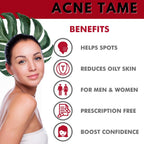 Acnetame 2 Pack - Complemento para piel clara - Pastillas para piel grasa, imperfecciones y control del sebo