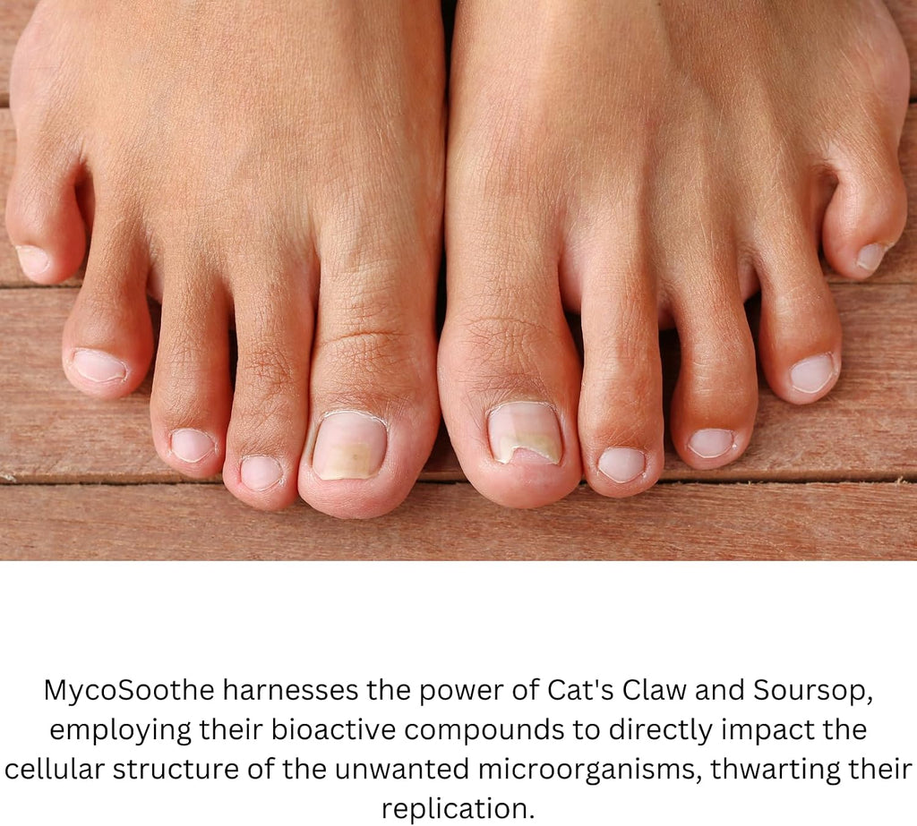 Phytage Labs MycoSoothe Advanced Hair, Skin, Nail & Immunity Support Formula - 60 Cápsulas