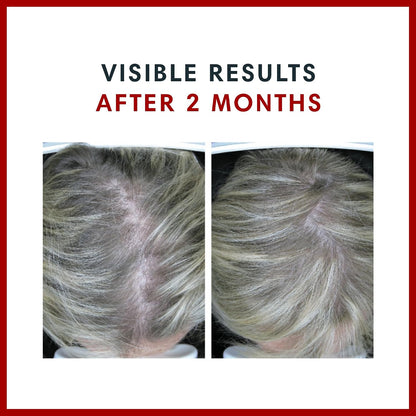 Consult Health BIOTIN GAIN Gummies con – El mantenimiento del cabello en condiciones normales. – Image 3