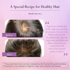 Omvi Formulas, Suplemento para el Crecimiento del Cabello con Biotina 20.000 mcg, Colágeno, Queratina, Vitaminas A, C, D3 y B12, Cabello, Piel y Uñas Fuertes, No OGM, Sin Gluten, 120 Cápsulas