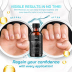 Metanail Toenail Liquid (2 Pack)