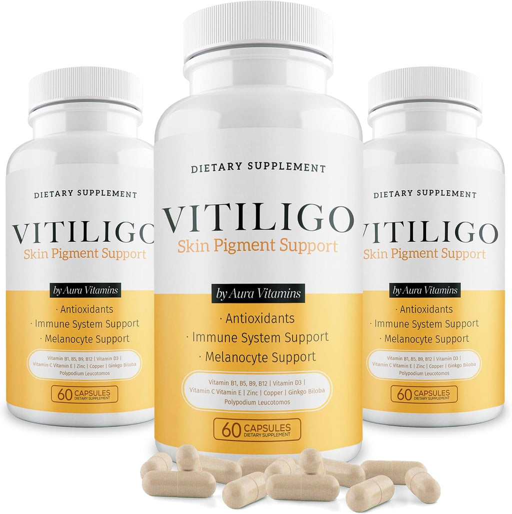 Dermawonder Vitiligo Capsules 60 Cápsulas | Suplemento para la Pigmentación de la Piel