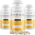 Dermawonder Vitiligo Capsules 60 Cápsulas | Suplemento para la Pigmentación de la Piel