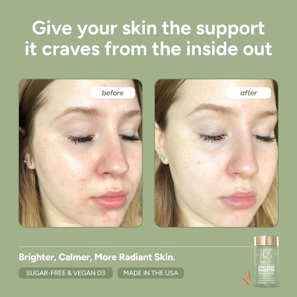 Halo Beauty Kiwi Seed Booster - Suplemento para la Piel Pack de Recarga | 1 Mes
