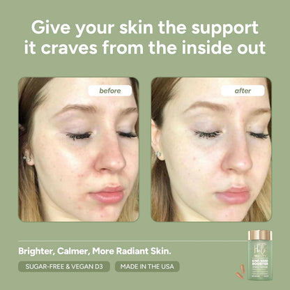 Halo Beauty Kiwi Seed Booster - Suplemento para la Piel Pack de Recarga | 1 Mes – Image 5