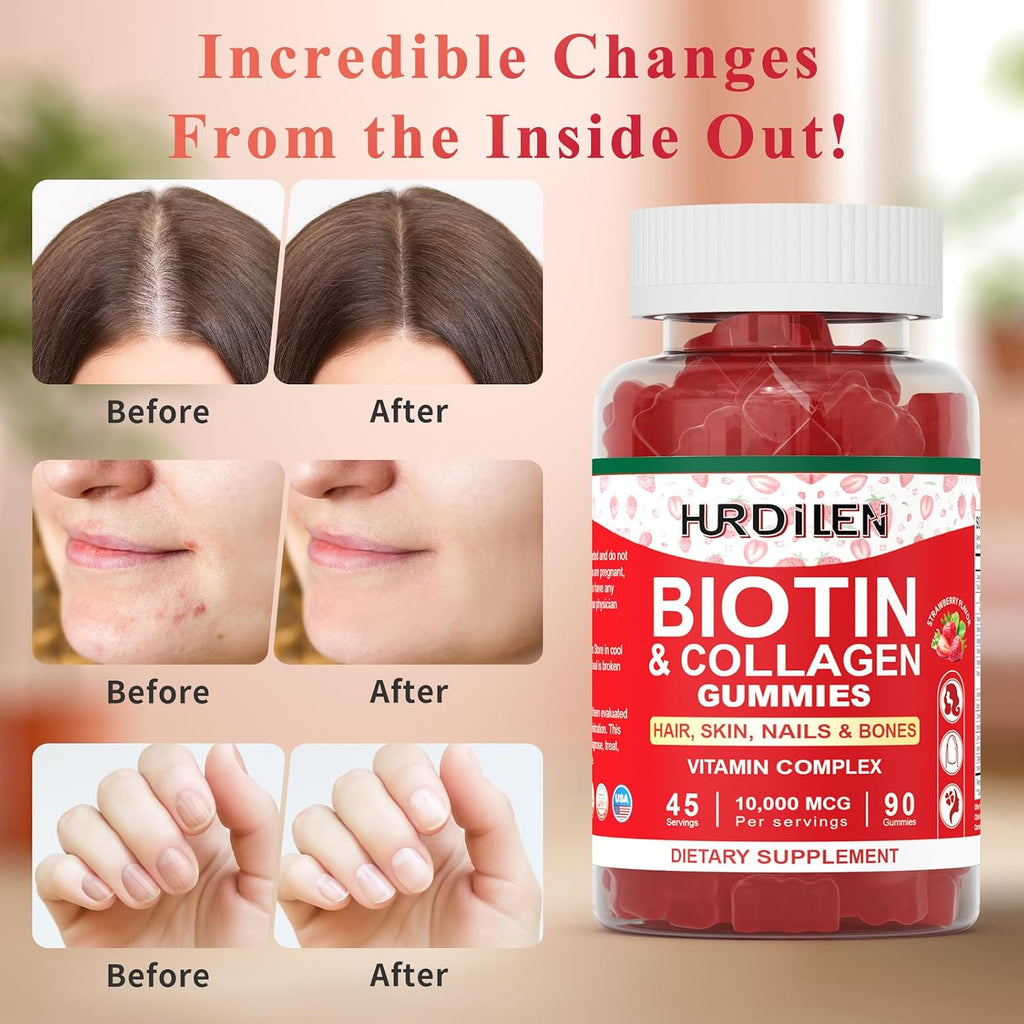 Hurdilen Biotina Colágeno Gummies 10000mcg - 90 Gominolas para Cabello, Piel y Uñas