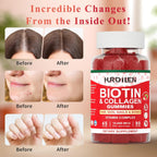 Hurdilen Biotina Colágeno Gummies 10000mcg - 90 Gominolas para Cabello, Piel y Uñas