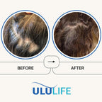 ULULIFE Ultimate Regrow Multivitamin: Healthy Hair, Skin, and Nails - 180 Capsules