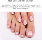 Phytage Labs MycoSoothe Advanced Hair, Skin, Nail & Immunity Support Formula - 60 Cápsulas