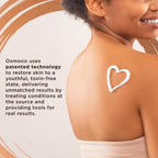 OSMOSIS Skin Aid, Microbioma y Vitamina A, Piel Propensa a Imperfecciones, 90 Cápsulas