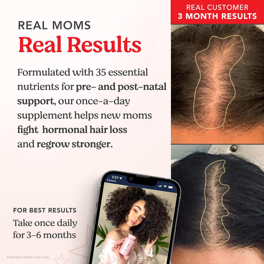 HAIRtamin MOM Complejo Prenatal y Postnatal Vegano - 30 Cápsulas