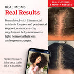 HAIRtamin MOM Complejo Prenatal y Postnatal Vegano - 30 Cápsulas