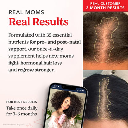 HAIRtamin MOM Complejo Prenatal y Postnatal – Vitaminas A, C, D y E: Actúan como antioxidantes y contribuyen a – Image 4