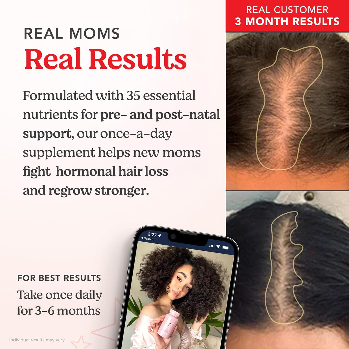HAIRtamin MOM Vitaminas Prenatales y – Probióticos y enzimas digestivas: Diseñados para facilitar la digestión y – Image 4