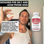 Acnetame Acne Pills 2 Pack 120 Cápsulas - Suplemento Vitamínico para el Acné