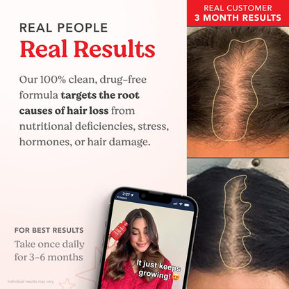 HAIRtamin Advanced Formula Biotina 5000 mcg – Metabolismo energético: La biotina contribuye al metabolismo – Image 4