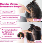 Pink Stork Gominolas para la Caída del Cabello Postparto, 60 unidades | Biotina, Ácido Pantoténico, Vitamina E, B6, B12