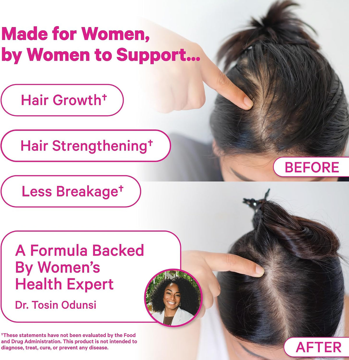 Pink Stork Gominolas para la Caída del – La biotina contribuye al mantenimiento del cabello en condiciones – Image 3