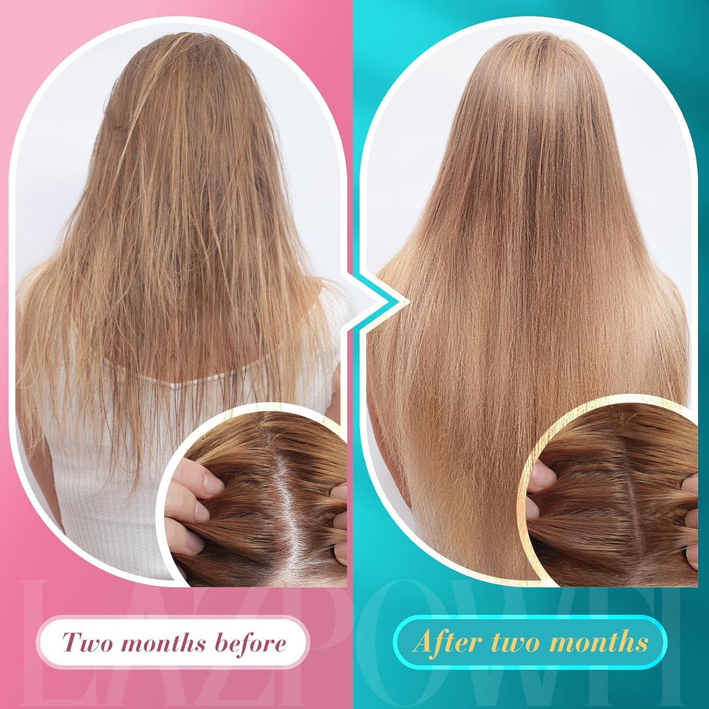 Lazpowfi Gomitas de Biotina para Cabello, Piel y Uñas - 60 Gomitas Sabor Fresa