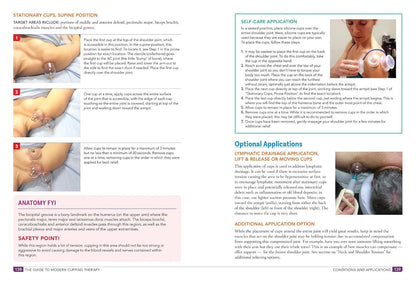 The Guide to Modern Cupping Therapy: Your – Protocolos para diferentes áreas del cuerpo: espalda, hombros, piernas – Image 3