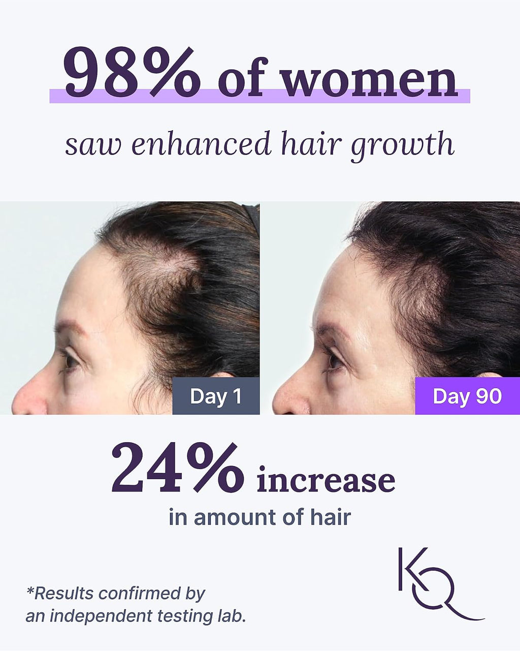 Keranique Suplementos para Cabello y Cuero Cabelludo con Biotina, Vitaminas B y Nutrientes Esenciales
