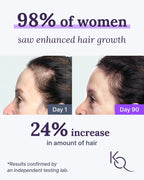 Keranique Suplementos para Cabello y Cuero Cabelludo con Biotina, Vitaminas B y Nutrientes Esenciales