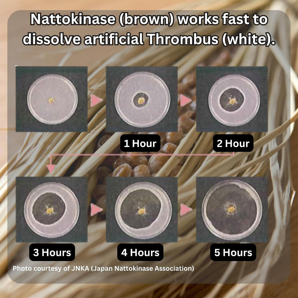 Nattokinase 2.000 FU y Kéfir - Suplemento para el Apoyo Cardiovascular - Fabricado en Japón (30 Cápsulas)
