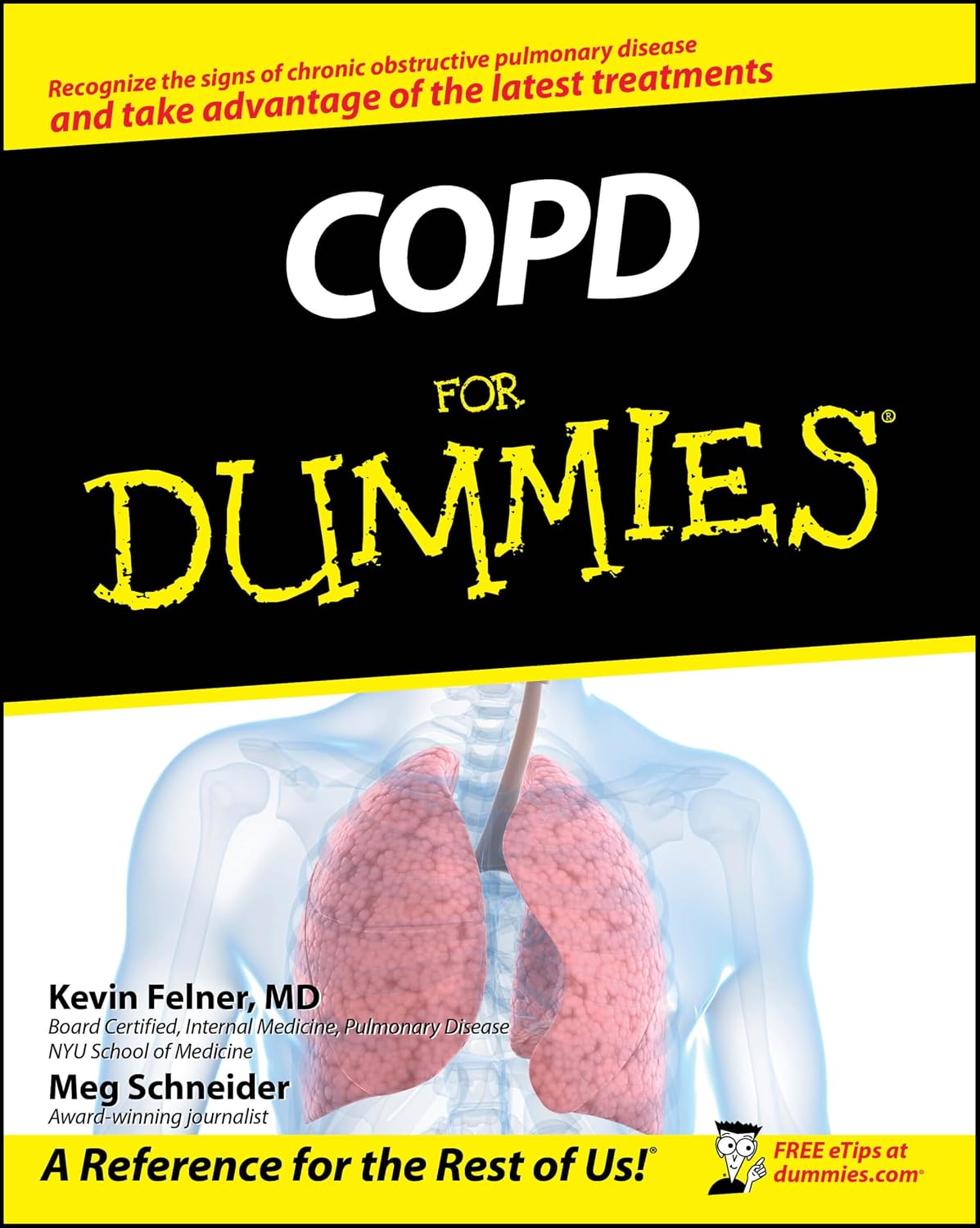 EPOC para Dummies
