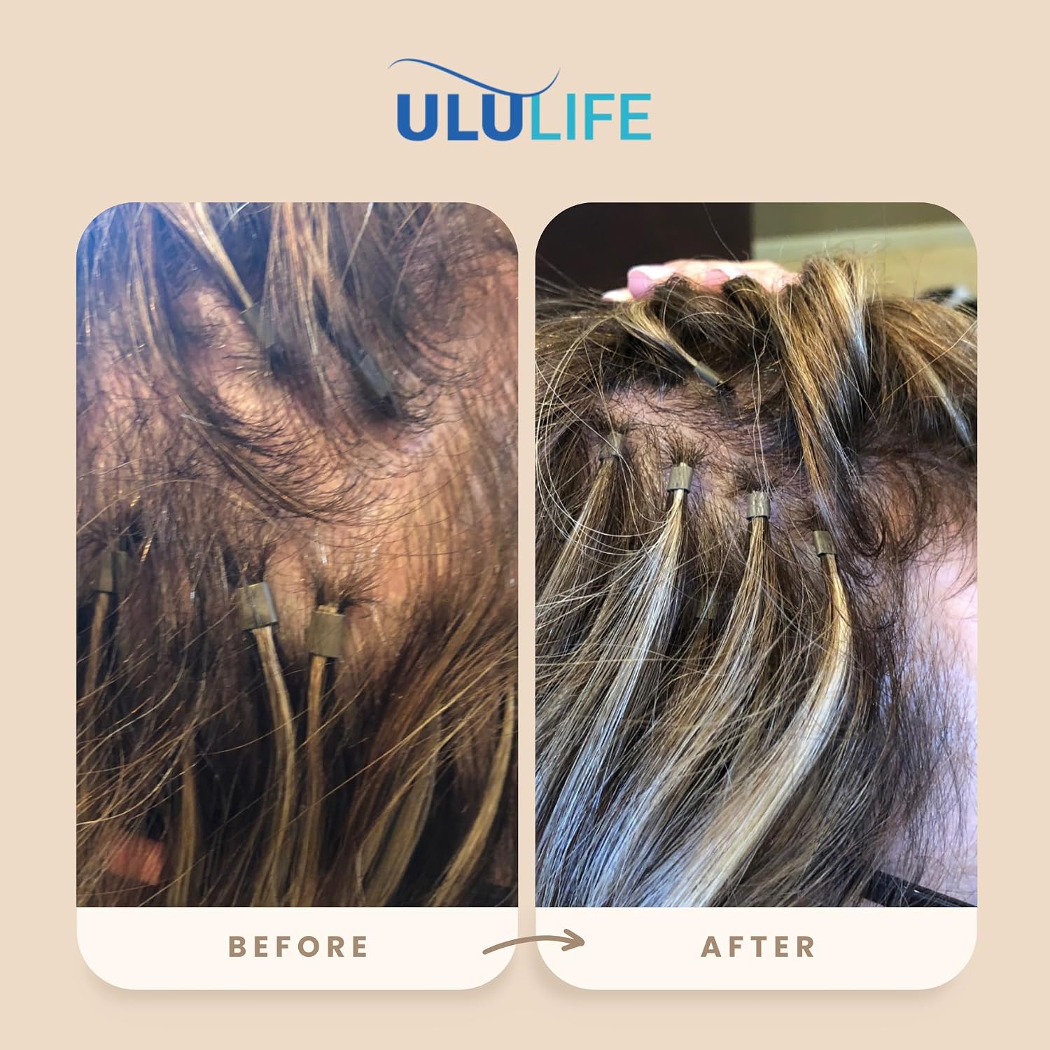 ULULIFE Multivitamínico Completo para Hombres y Mujeres - Biotina, Colágeno, Keratina - 180 Cápsulas (60 Días)