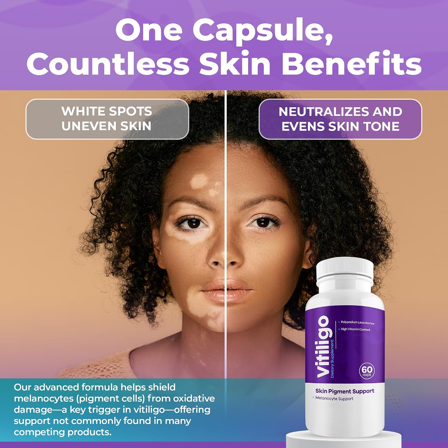 AURA VITAMINS - Cápsulas de Apoyo a la Pigmentación Cutánea, 60 Cápsulas