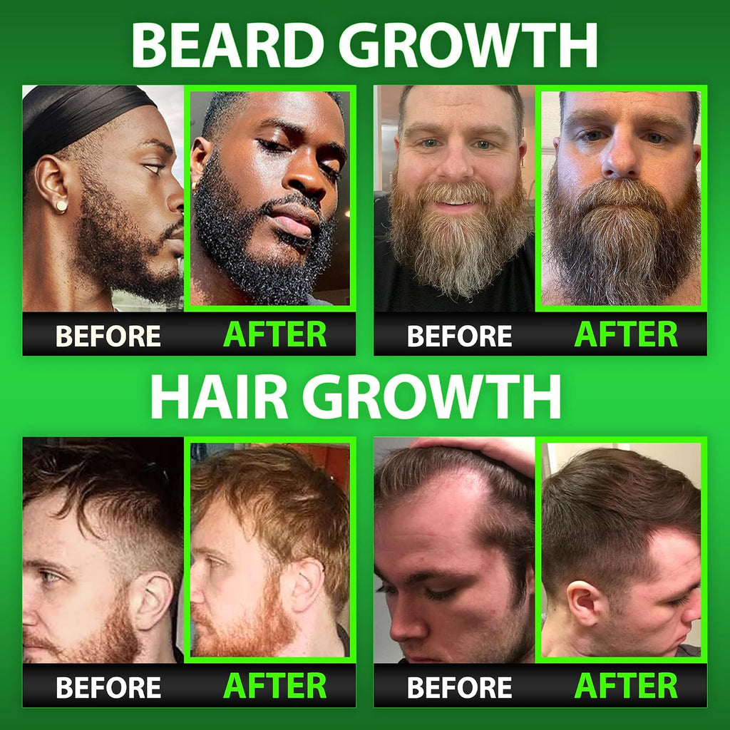 BBS Best Beard Stuff Gominolas de Biotina - 620,000mcg
