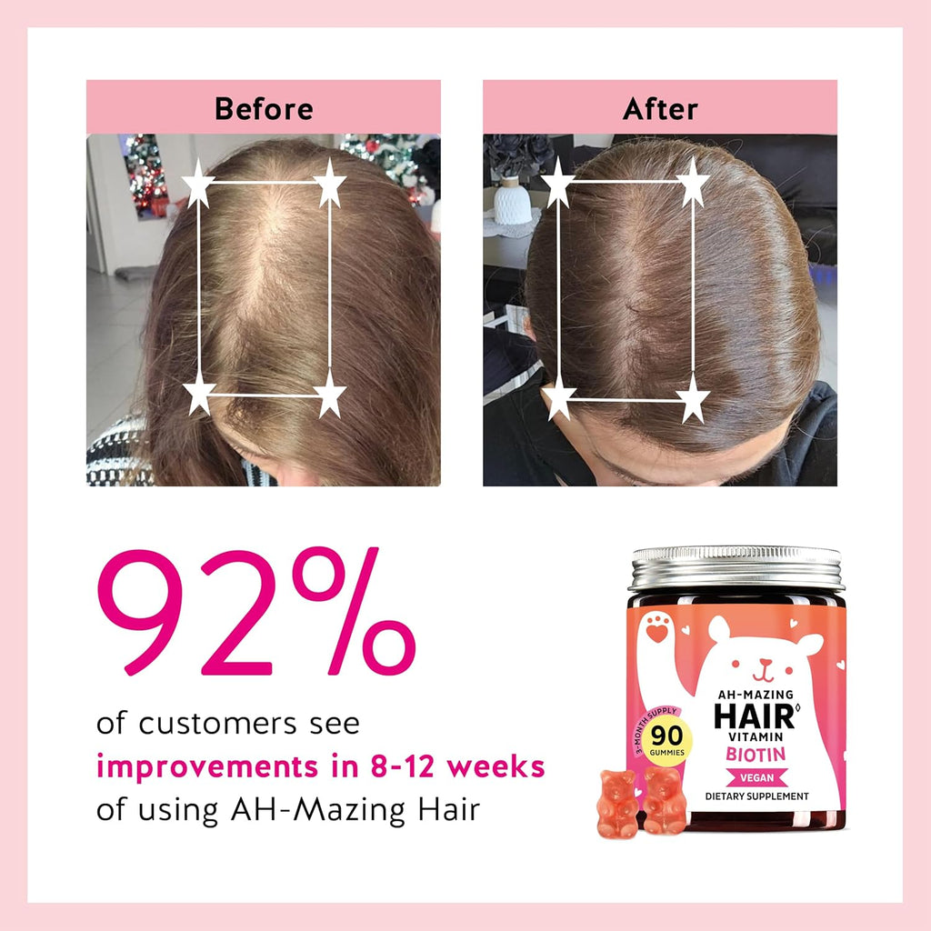 Gominolas de Biotina 5,000 mcg para Cabello, Piel y Uñas – con Vitaminas C y E – 90 Gominolas – Vegano