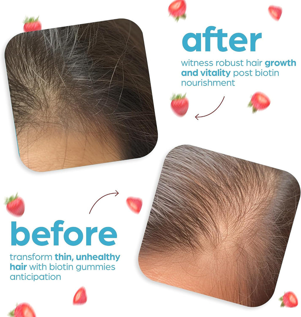 Artnaturals Gominolas de Biotina 10000mcg – Apoyo para Cabello, Piel y Uñas – 100 Gominolas