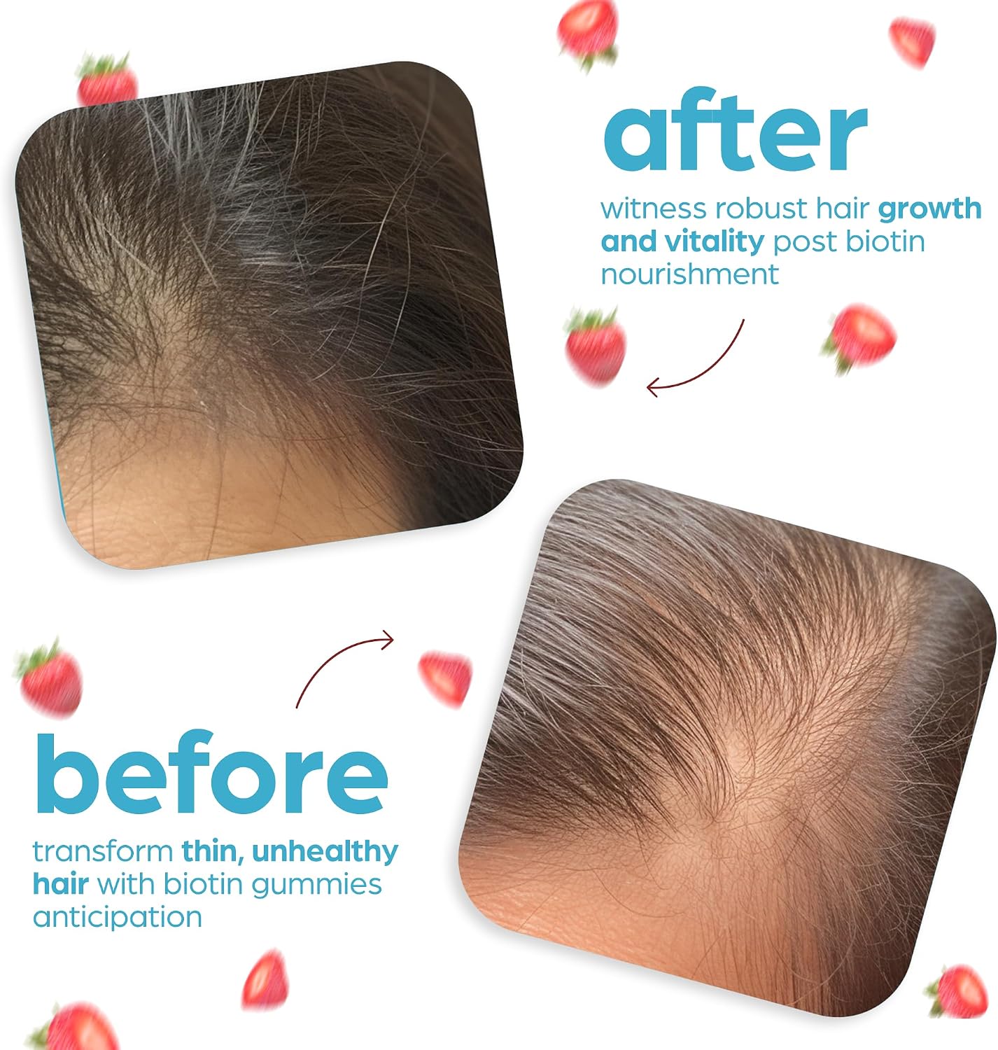Artnaturals Gominolas de Biotina 10000mcg – Apoyo para Cabello, Piel y Uñas – 100 Gominolas