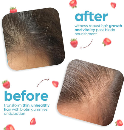 Artnaturals Gominolas de Biotina 10000mcg – Apoyo para Cabello, Piel y Uñas – 100 Gominolas – Image 5