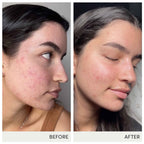 jane iredale Skin Accumax Suplemento Nutricional en Cápsulas - Vitaminas A, C y E - Vegano y Sin Gluten