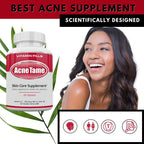 Acnetame 2 Pack - Complemento para piel clara - Pastillas para piel grasa, imperfecciones y control del sebo