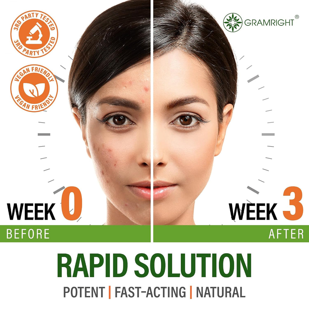 Perfect Skin Acne Pills - Suplemento Antiacné con Niacinamida, Probiótico, Zinc y Vitamina A - 60 Cápsulas