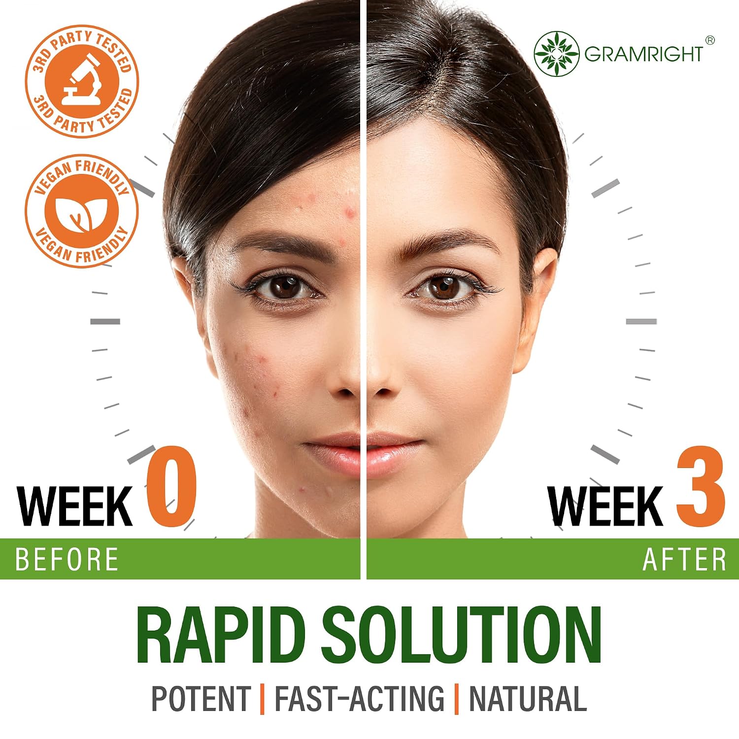 Perfect Skin Acne Pills - Suplemento Antiacné con Niacinamida, Probiótico, Zinc y Vitamina A - 60 Cápsulas