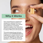 CLEARSTEM - MINDBODYSKIN Hormonal Acne Supplement (No 5-HTP) - Natural DIM Supplement - Skin Care Vitamins - Hormone Balance, Antioxidants - Gluten Free, Cruelty Free - 30 Servings, 90 Capsules