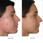 jane iredale Advanced Nutrition Programme Skin Accumax Suplemento Nutricional para la Piel