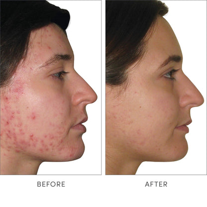 jane iredale Advanced Nutrition Programme – Vitamina E: Actúa como antioxidante, protegiendo las células frente a – Image 3