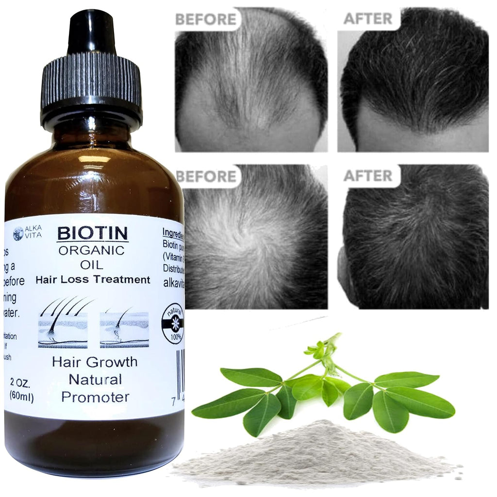 Aceite Orgánico de Biotina con Sílice para el Cabello - ALKA VITA