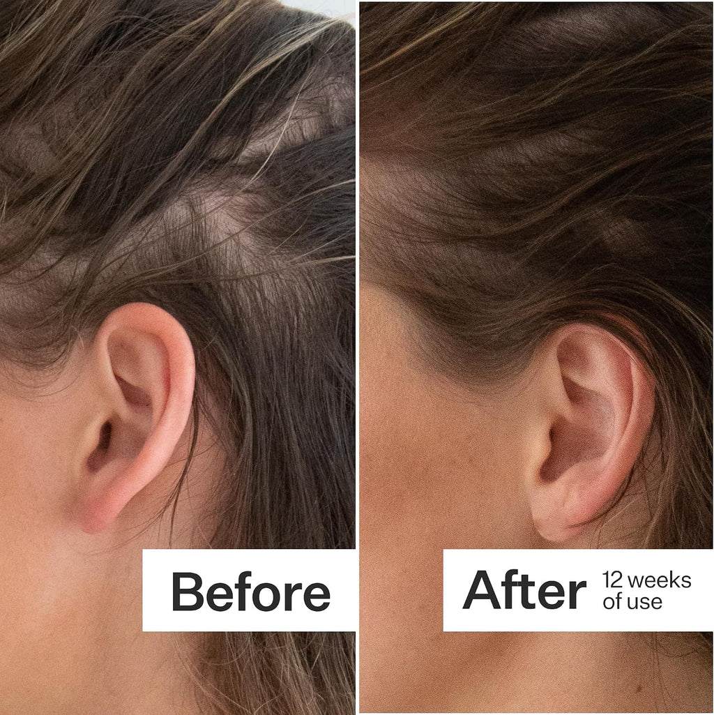 ACT+ ACRE Thick + Full Hair Capsules | Cápsulas para Cabello Más Grueso y Fuerte | Bambú, Cola de Caballo, Biotina, Vitamina C | Fortalece Raíces, Vegano, Sin Gluten, con Esencia de Menta | 60 Cápsulas