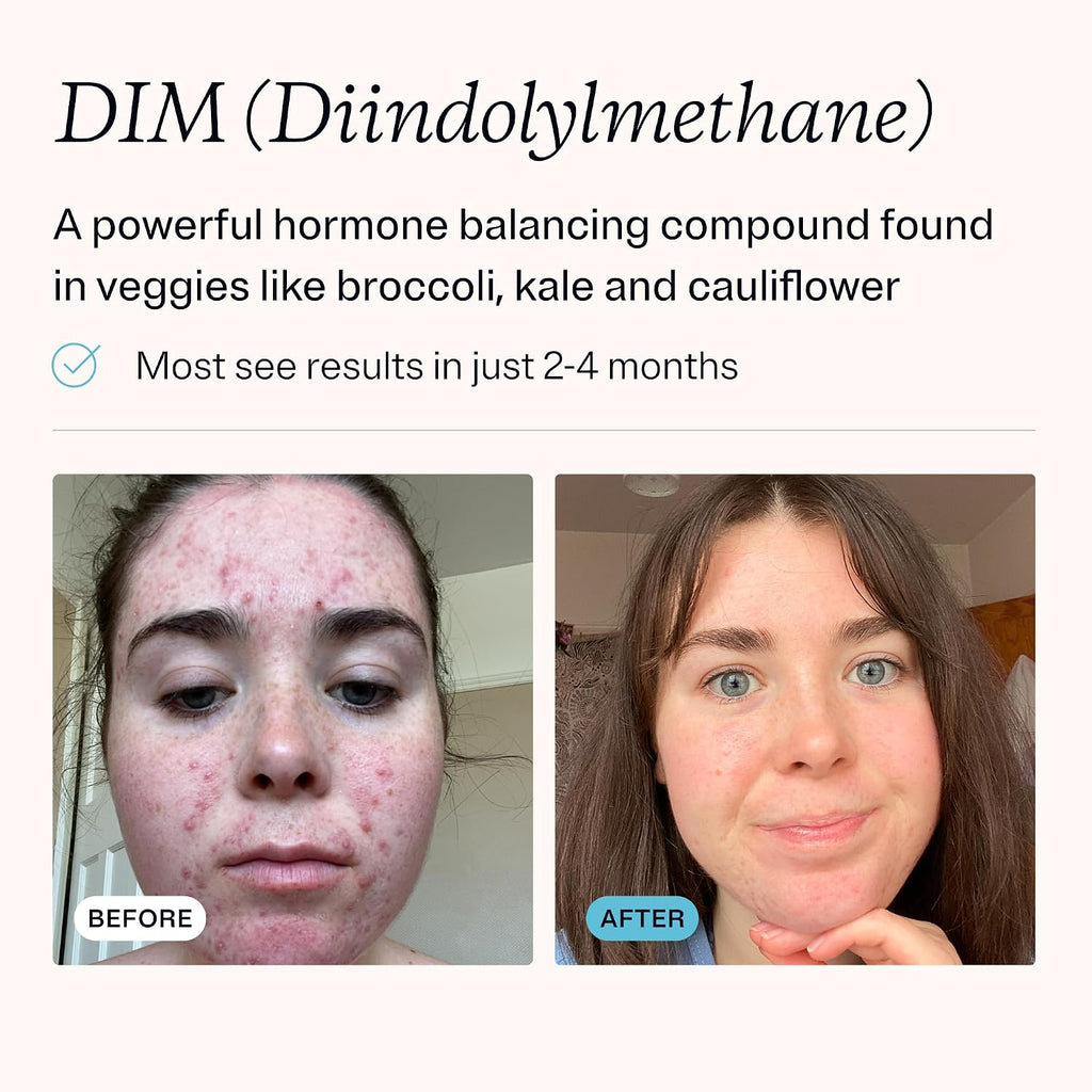 MDacne DIM con Extracto de Crucíferas y Bioperina - 30 Cápsulas Veganas