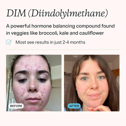MDacne DIM con Extracto de Crucíferas y Bioperina - 30 Cápsulas Veganas – Image 3