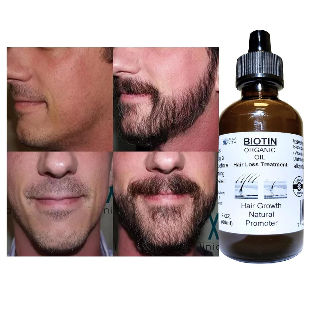 Aceite Orgánico de Biotina con Sílice para el Cabello - ALKA VITA